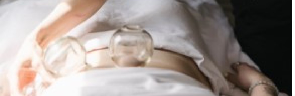 Evodia Acupuncture Cover Image