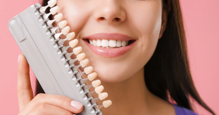 Full-Arch Restoration & Veneers Seattle | Bellevue & Alaska